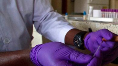 Photo of Scientists Warn;Uganda Off 2030 HIV Target