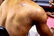 Photo of Abductions, Torture, and Silence: The Unrelenting Ordeal of NUP Supporters in Uganda