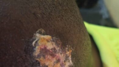 Photo of Fresh Attacks Emerge After Court Victory: Dr. Ssemugenyi Accuses Unknown Operatives of Brutalizing Staff
