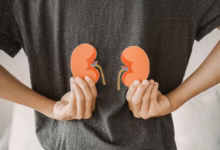 Photo of Kidney disease is growing in Africa: big new study casts light on genetic risk factors